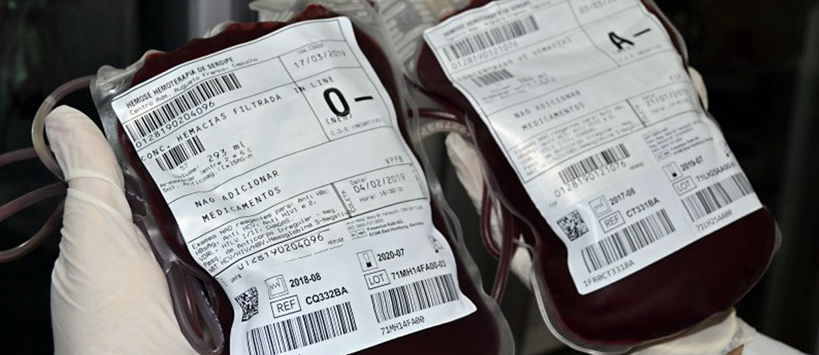 Critérios para coleta de sangue são essenciais para a segurança do doador