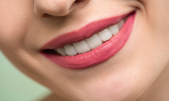 Clareamento dental pode auxiliar no resgate da autoestima