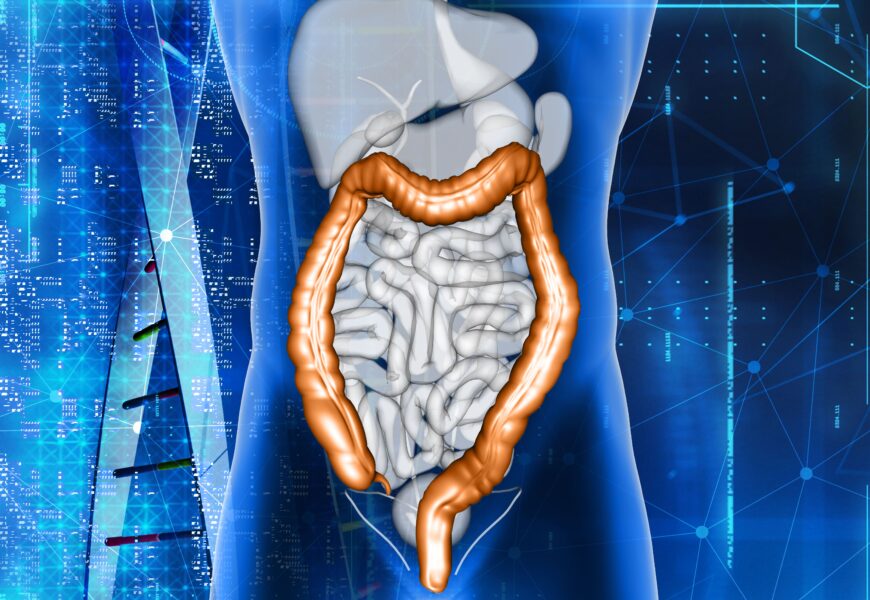 Câncer colorretal: uma ameaça silenciosa, letal e cada vez mais presente no Brasil Câncer colorretal: uma ameaça silenciosa, letal e cada vez mais presente no Brasil