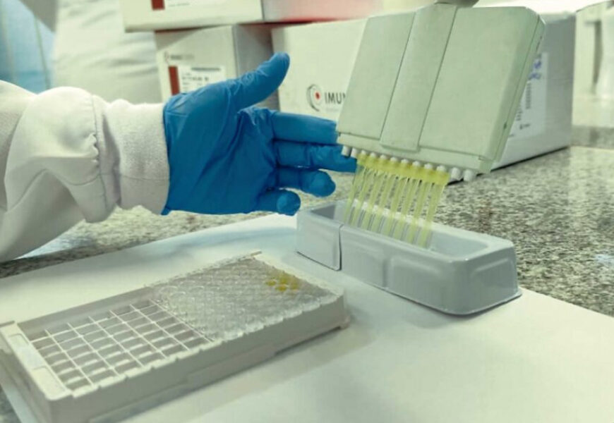 Saúde do Estado reforça vigilância contra a ‘gripe K’ em Sergipe Saúde do Estado reforça vigilância contra a ‘gripe K’ em Sergipe